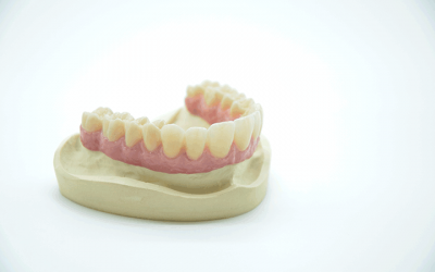 Coverdenture-aus-Zirkon-auf-Implantaten